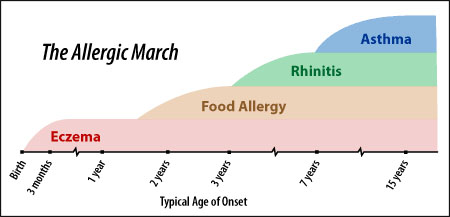 The Allergic March